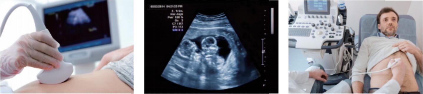 Sistema de diagnóstico por ultrassom móvel